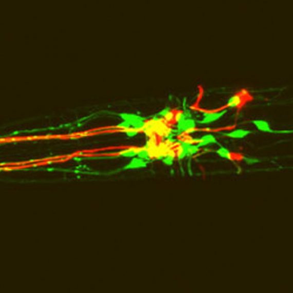 C. elegans expressing red fluorescent protein in dopamine neurons and green fluorescent protein in dopamine receptor-expressing neurons.