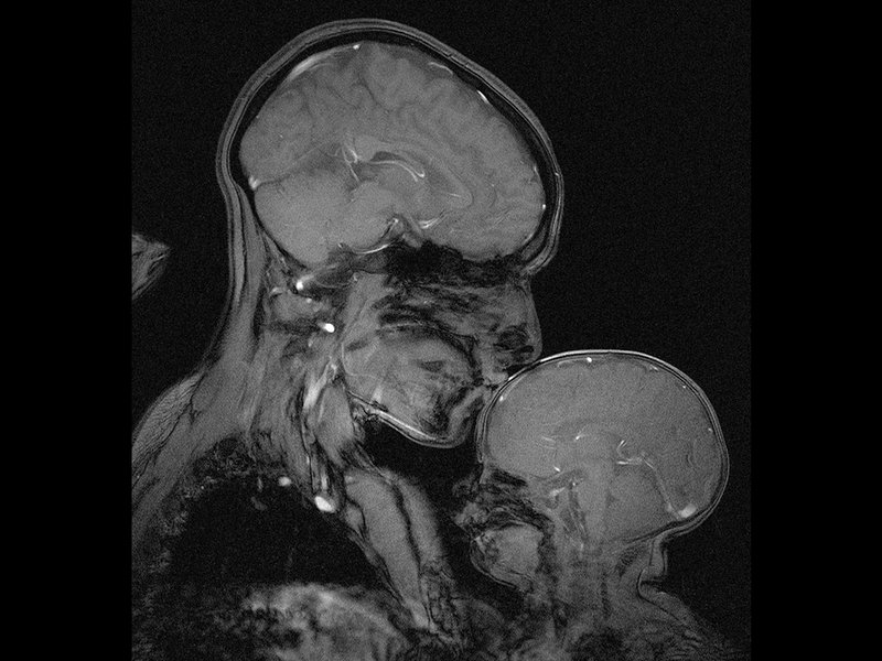 Mother + Child MRI Print (created by Rebecca Saxe)