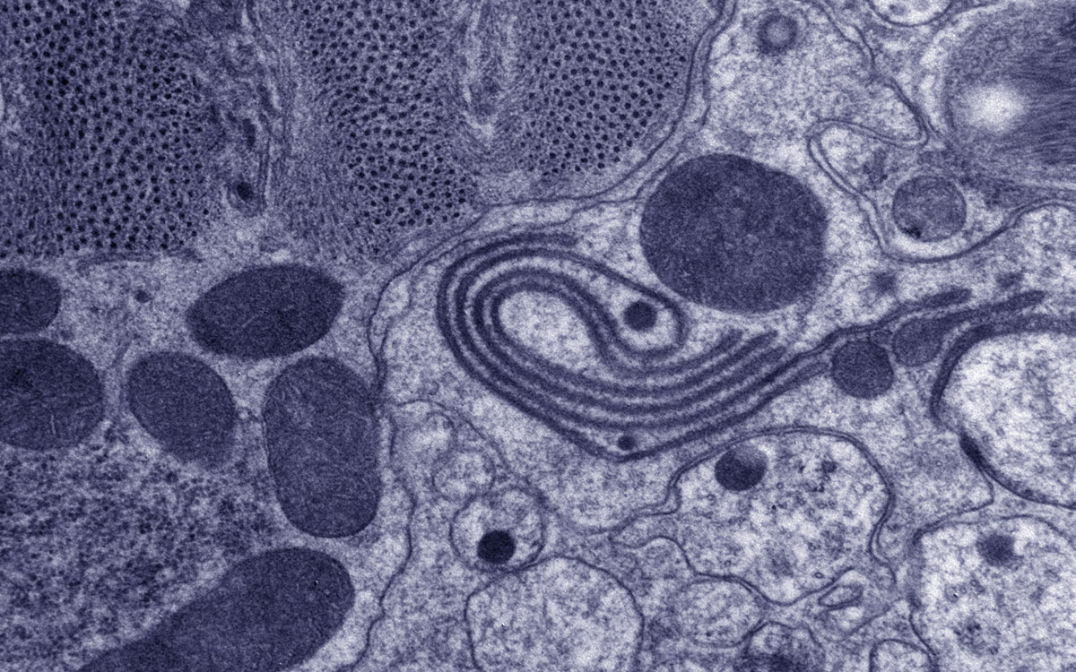 C. elegans electron micrograph