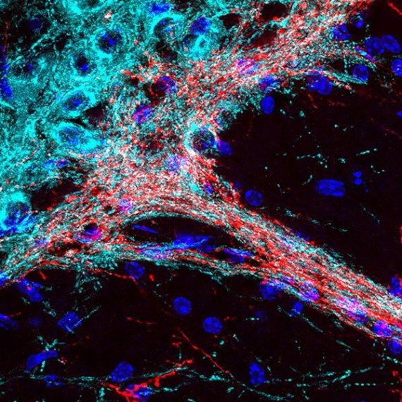Dopamine-containing neurons in basal ganglia circuits of the brain.