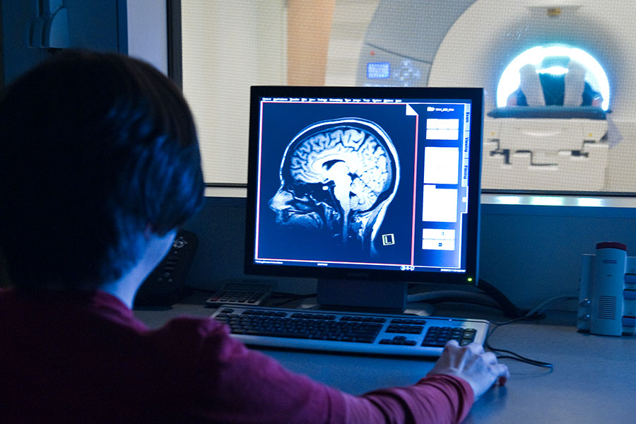 woman looks at brain scan