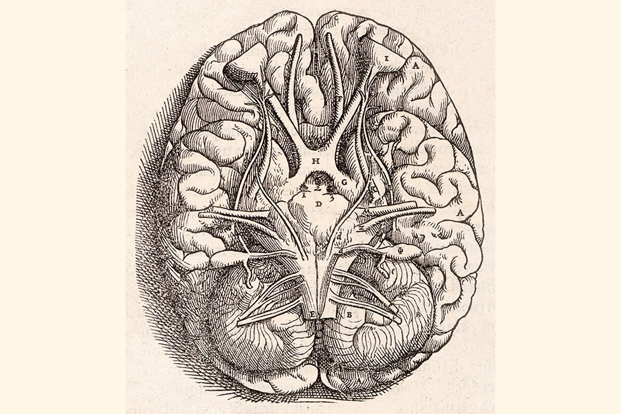 schizophrenia brain