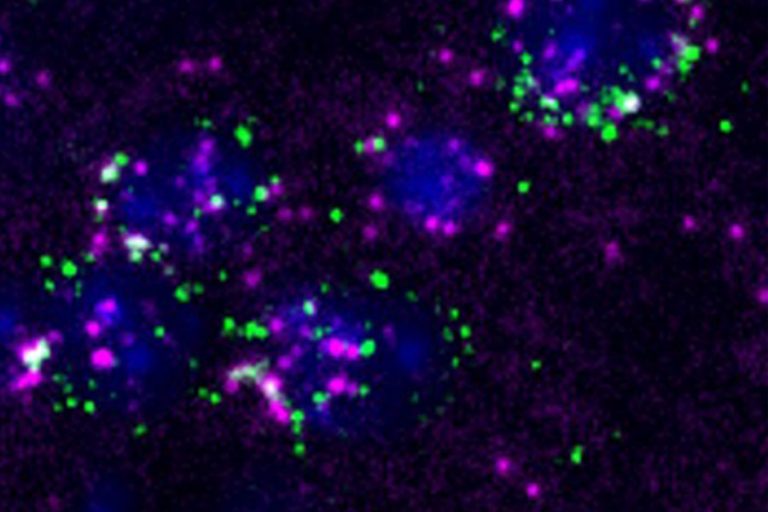 How Huntington’s disease affects different neurons - MIT McGovern Institute