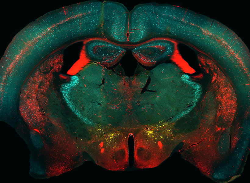 Microscopic image of mouse brain