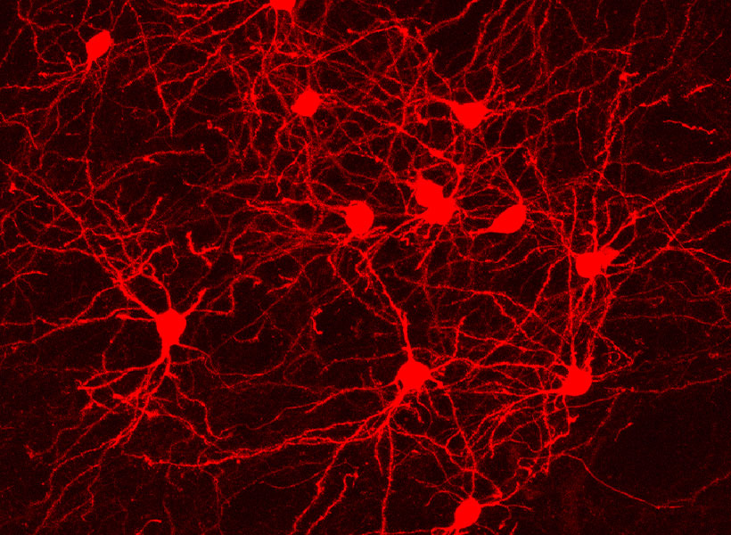 Neurons illuminated in red under a microscope