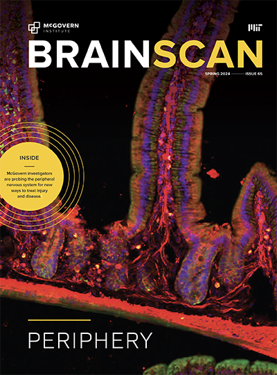 Cover of BrainScan Issue number 65 - Spring 2024.