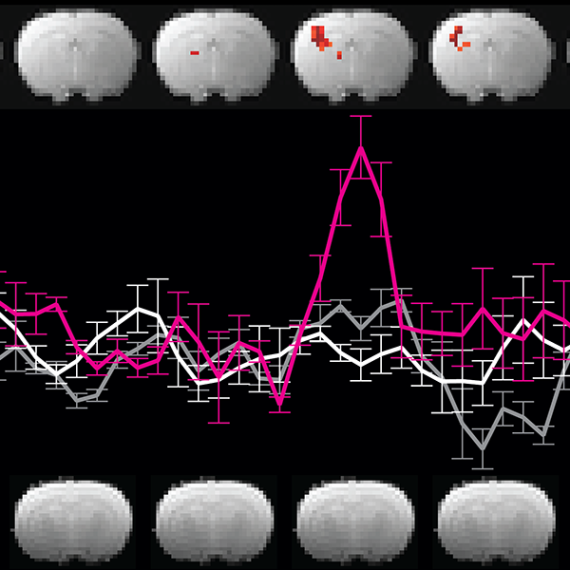 Two rows of brain scans with a line graph in between.