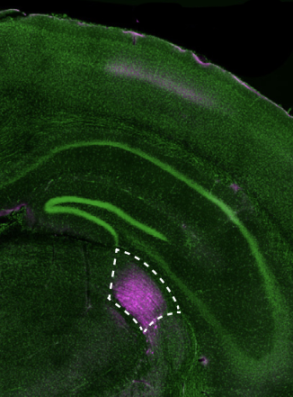 Microscopic image of a mouse brain.