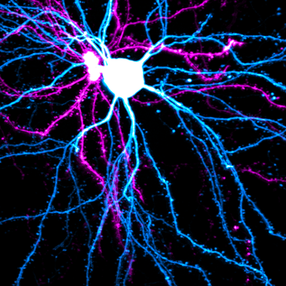 Microscopic image of two pyramidal neurons.