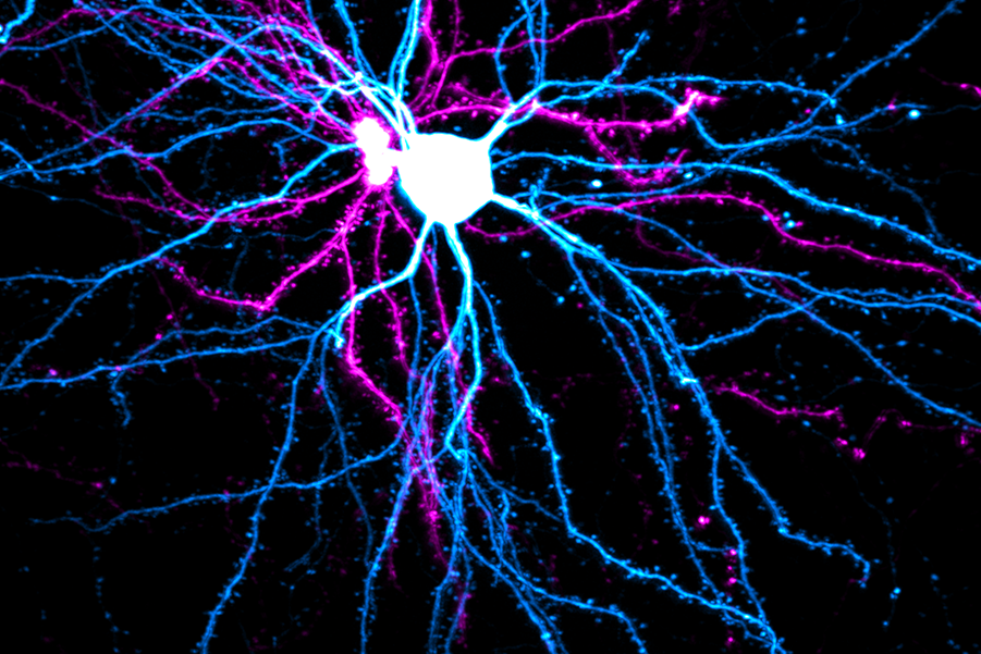 Microscopic image of two pyramidal neurons.