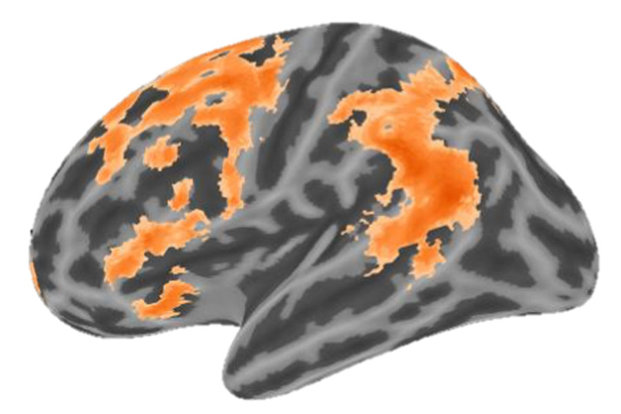 Computer generated image of brain with orange regions indicating activity.