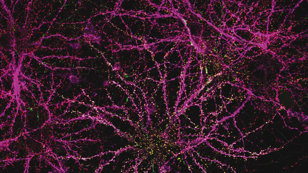 Image of SHANK3 therapy correctly finding its way to dendrites. Image: Guoping Feng