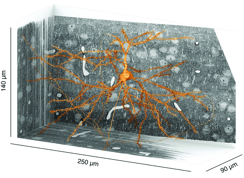An image of an orange neuron emerging from black and white brain slices. 
