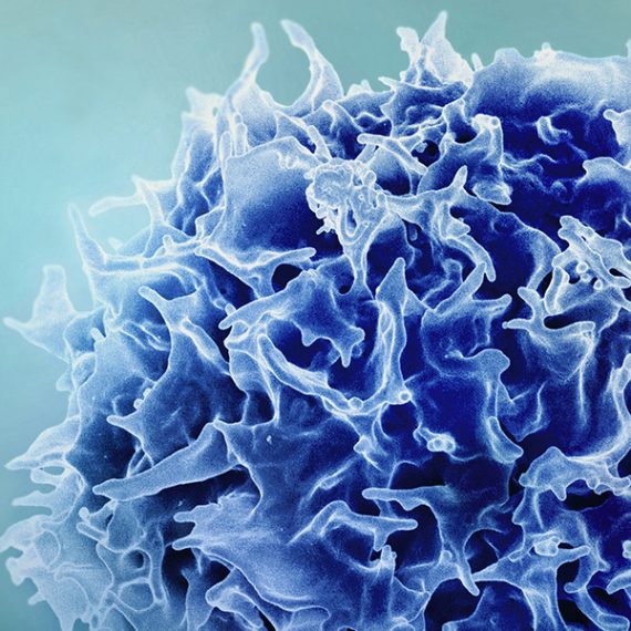 colorized scanning electron micrograph of a T cell (T lymphocyte).