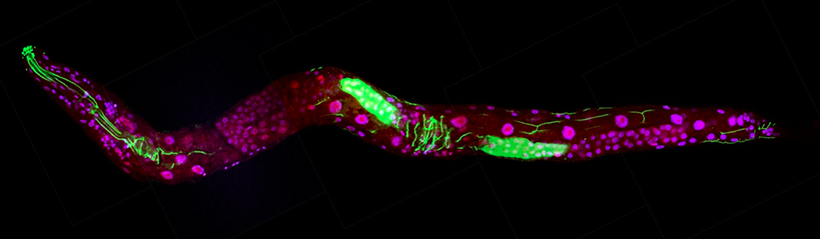 Microscopic image of C. elegans roundworm with cells highlighted in pink and green.