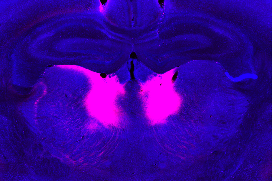 A slice of mouse brain dyed purple showing two pink blobs towards the center.