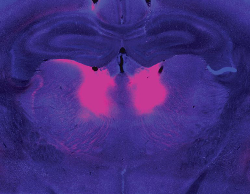 A slice of mouse brain dyed purple showing two pink blobs towards the center.