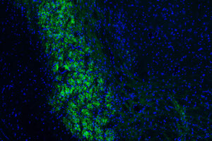 Green and blue cells as seen under a microscope