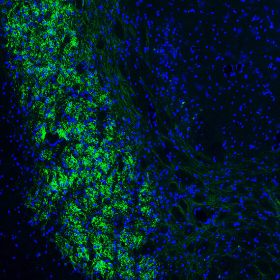 Green and blue cells as seen under a microscope