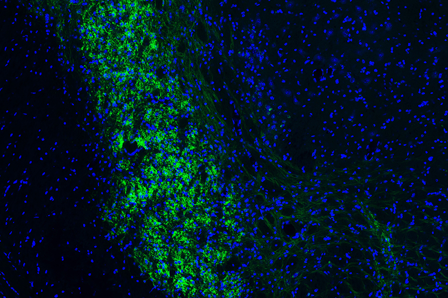 Green and blue cells as seen under a microscope