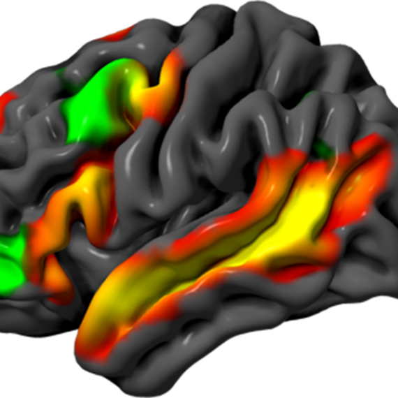 A graphic of the human brain in grey, with different regions highlighted in red, green, and yellow.