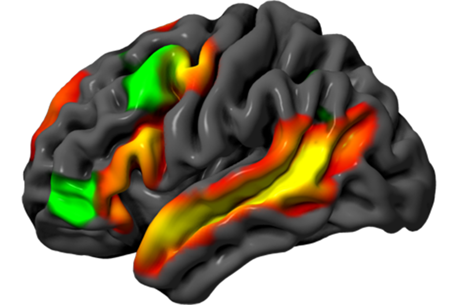 A graphic of the human brain in grey, with different regions highlighted in red, green, and yellow.